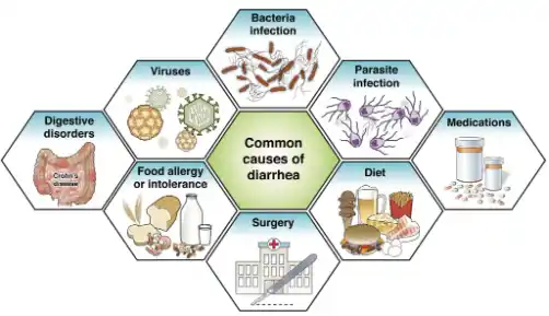 Diarrhea graphic